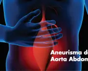 Aneurisma da Aorta Abdominal (2)