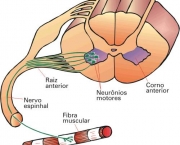 atrofia-muscular-por-falta-de-uso-ou-neurologica-2