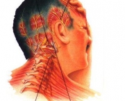 cefaleia-tensional-informacoes-sobre-o-problema-2