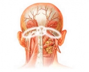 cefaleia-tensional-informacoes-sobre-o-problema-4