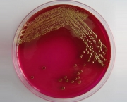 como-se-proteger-das-bacterias-e-das-doencas-9