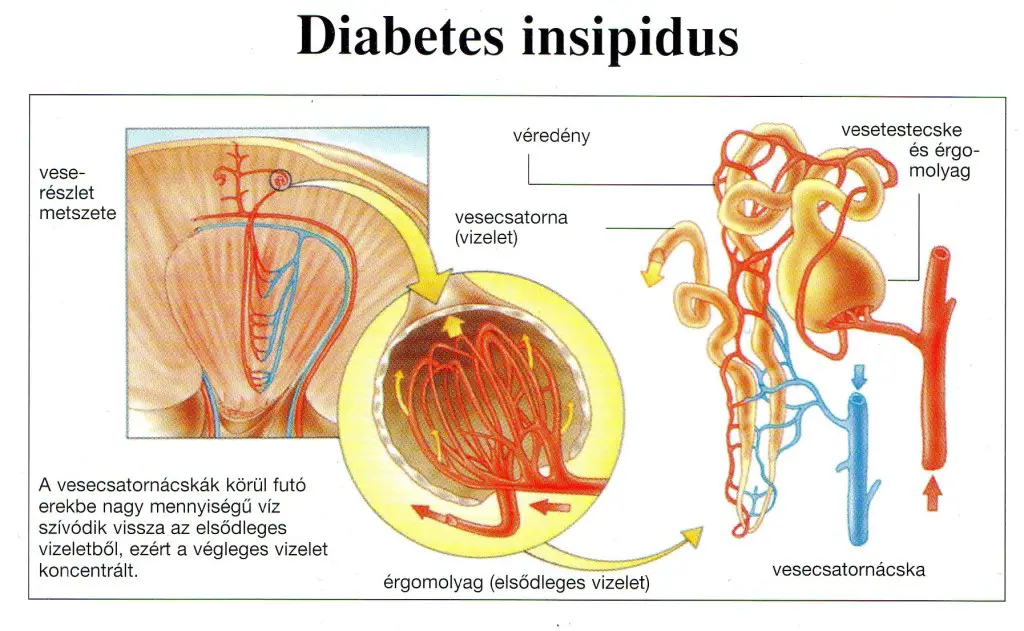 diabetes insipidus natrium urine)