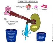 Diabetes Insipidus (14).jpg
