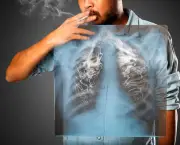 Doença Causadas Pelo Cigarro (6)