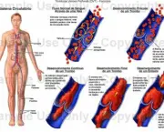 doencas-do-aparelho-circulatorio-4