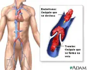 doencas-do-aparelho-circulatorio-6