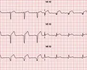 Eletrocardiograma (2)