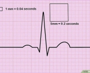Eletrocardiograma (10)