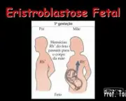 Eritroblastose Fetal (13)