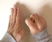 Flexor Superficial dos Dedos - Inervação (14)
