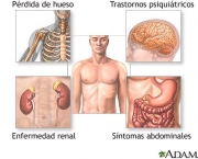hiperparatiroidismo-definicao-causas-sintomas-e-tratamento-1