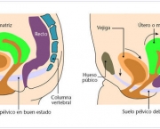 incontinencia-urinaria (2)