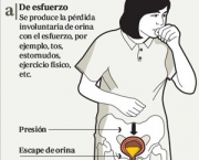 incontinencia-urinaria (3)