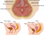 incontinencia-urinaria (15)