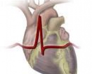foto-insuficiencia-cardiaca-congestiva-10