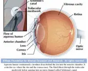 o-que-e-glaucoma-2