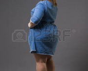 Obesidade Afeta Mais as Mulheres (6)