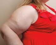 Obesidade Afeta Mais as Mulheres (7)