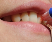 Erros Mais Comuns Sobre a Saúde Dental (9)