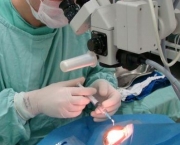 Pós-Operatório em Implante de Silicone (18)