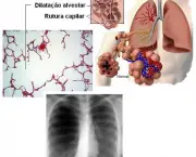 prevencao-de-infeccoes-respiratorias-o-que-podemos-fazer-para-os-livrar-desse-problema-2