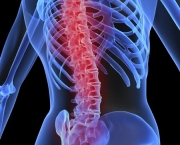 principais-sintomas-da-osteoporose-10