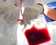 sangue-do-cordao-umbilical-caracteristicas-gerais-8