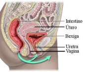 Sepse-urinária-1.jpg