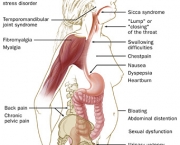 sindrome-do-intestino-irritavel-caracteristicas-gerais-2