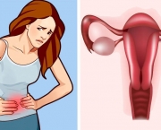 Terapêutica para Cólicas Menstruais (6)