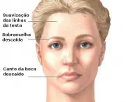 Tratamento da Paralisia Facial (10)
