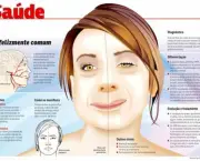 Tratamento da Paralisia Facial (11)