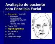 Tratamento da Paralisia Facial (14)
