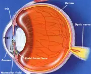 tudo-sobre-glaucoma-5