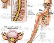 tudo-sobre-hernias-de-disco-problemas-na-coluna-vertebral-4