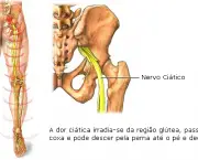 tudo-sobre-hernias-de-disco-problemas-na-coluna-vertebral-3