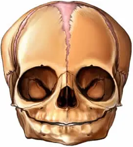 Formato do Crânio das Pessoas Portadoras da Síndrome de Crouzon
