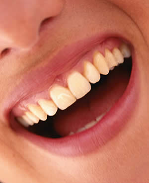 Sorriso Bonito com Dentes Brancos e Saudáveis