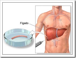 Biopsia do Fígado 