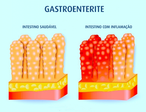 Diferenças Entre um Intestino Saudável e Outro com Gastroenterite Viral