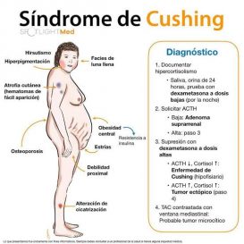 Síndrome de Cushing - Diagnóstico