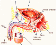 adenocarcinoma-de-prostata-o-cancer-de-prostata-6