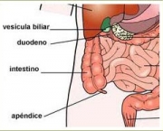 apendicite (1).jpg
