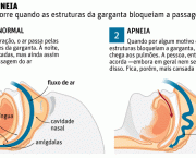 Os Riscos da Apneia do Sono (1)