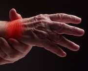 Como é a Artrite Reumatoide (6)