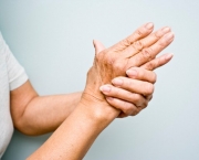 Como Aliviar Os Sintomas Da Artrite Reumatoide (2)
