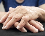 Como Aliviar Os Sintomas Da Artrite Reumatoide (3)