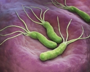 Bactéria no Estômago Pode Virar Câncer (14)