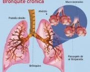 foto-bronquite-asmatica-04