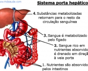 Cirrose Hepática (15)